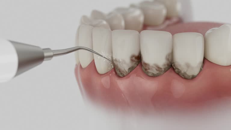 Reliable Dental Implants contractor in Odenton, MD by Smile Center Dentistry